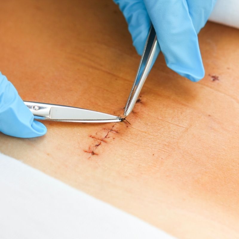 angeles a tu servicio tunja